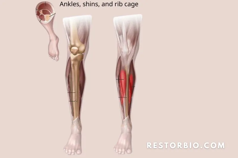 Ankles, shins, and rib cage