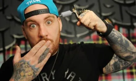 How Does Tattoo Removal Work – Procedure, Benefits And Cost