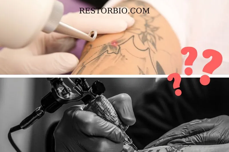 Does Tattoo Removal Hurt More Than Tattoo