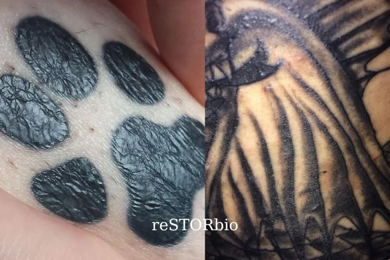 How Long Will My Tattoo Be Visible As Wrinkles