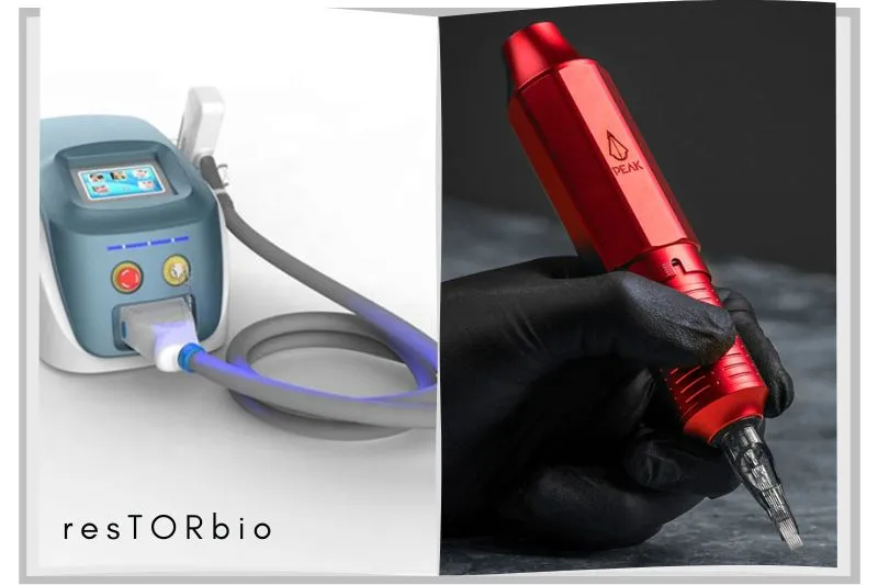 Invest In Tools For Tattoo Removal
