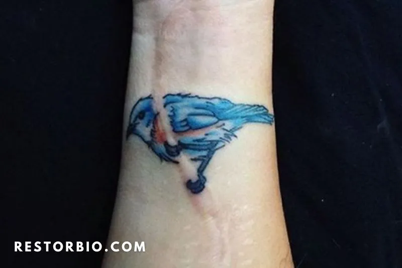 Is It Difficult to Get A Scar-Covering Tattoo