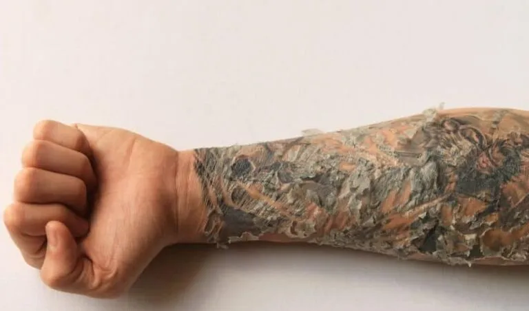 Do Tattoos Peel While Healing?