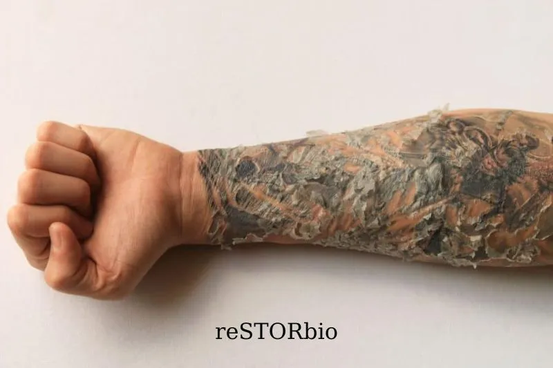 Peeling Tattoo