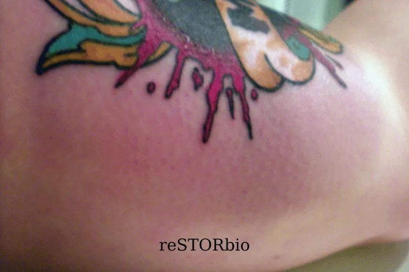 Rejection Of Ink Or Allergies
