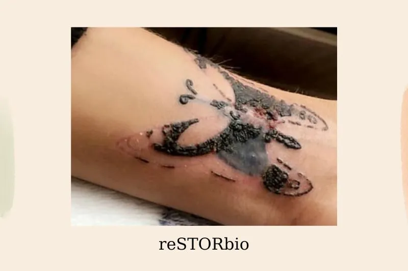 What Are The Signs Of Infected Tattoo