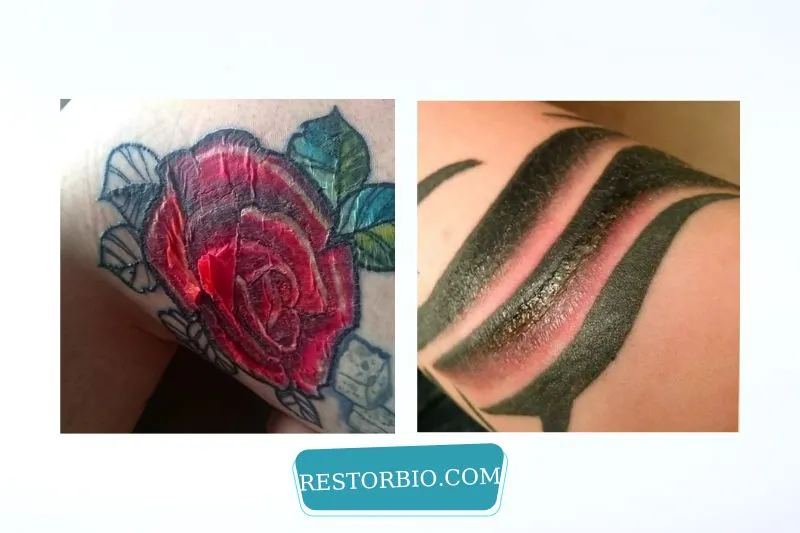 What Can You Anticipate If You Have A Tattoo