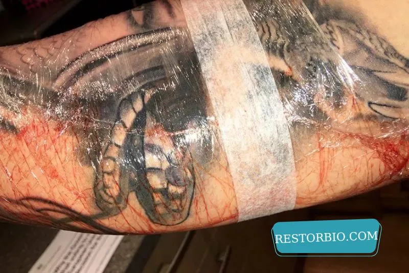 What to Do If a New Tattoo Doesn’t Stop Bleeding