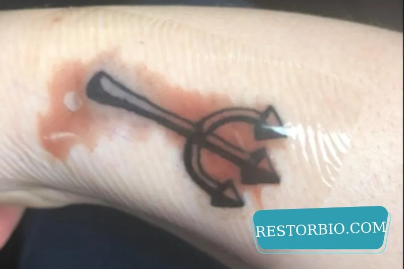 Why Do Tattoos Bleed