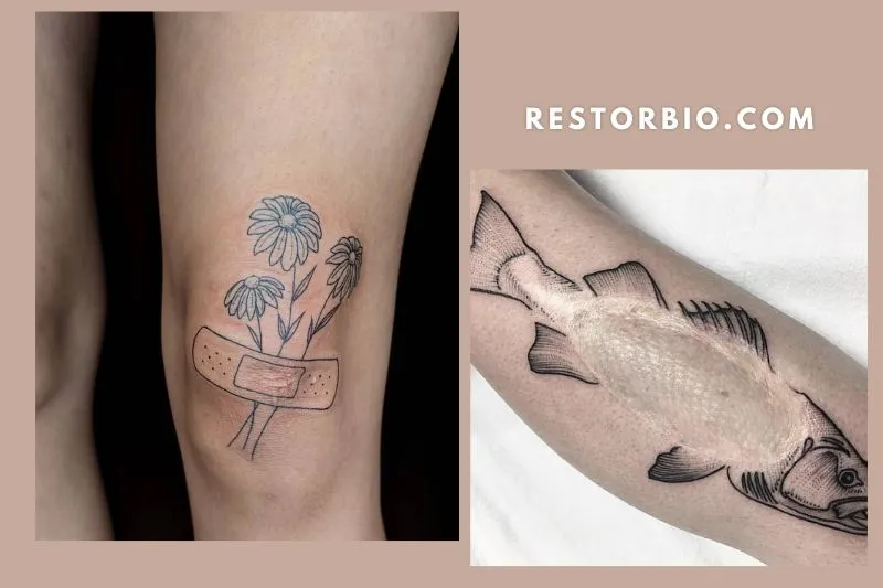 Your Tattoo Could Cause More Scarring