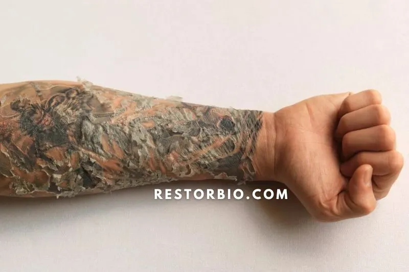Your Tattoo Might Appear Irregular