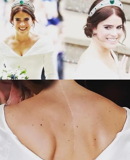 What Does Queen Elizabeth's Tattoo Mean, The Significance of Tattoos in British Royalty, Symbolism Behind Queen Elizabeth's Tattoo, Historical Context of Queen Elizabeth's Tattoo, Public Reaction to Queen Elizabeth's Tattoo, Influence of Queen Elizabeth's Tattoo on Modern Culture, Do any members of the British royal family have tattoos, What is the meaning behind the crown tattoo,
